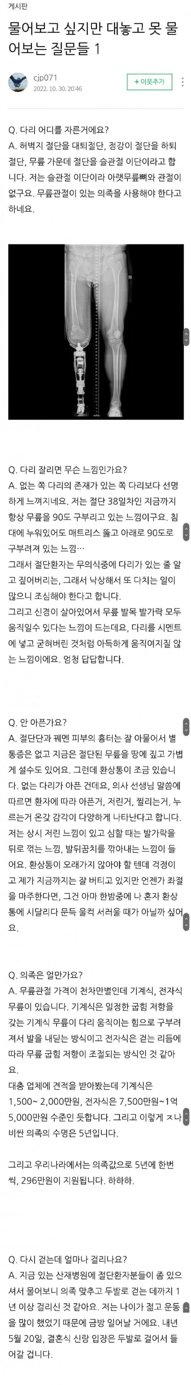 다리 절단 환자의 Q&A