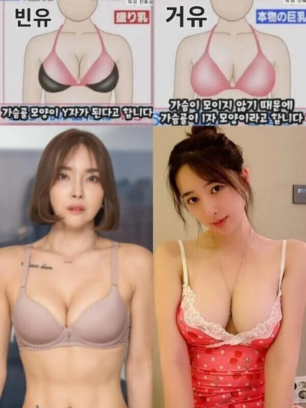 빈유와 거유 구분하는 방법