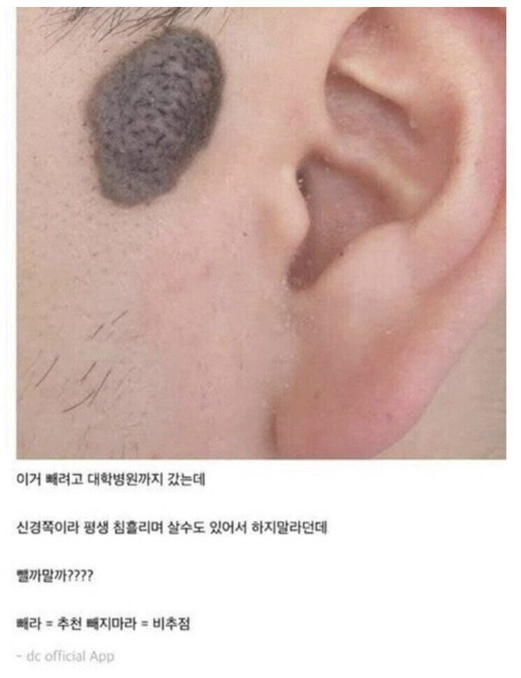얼굴점 인증샷 레전드 ㄷㄷ