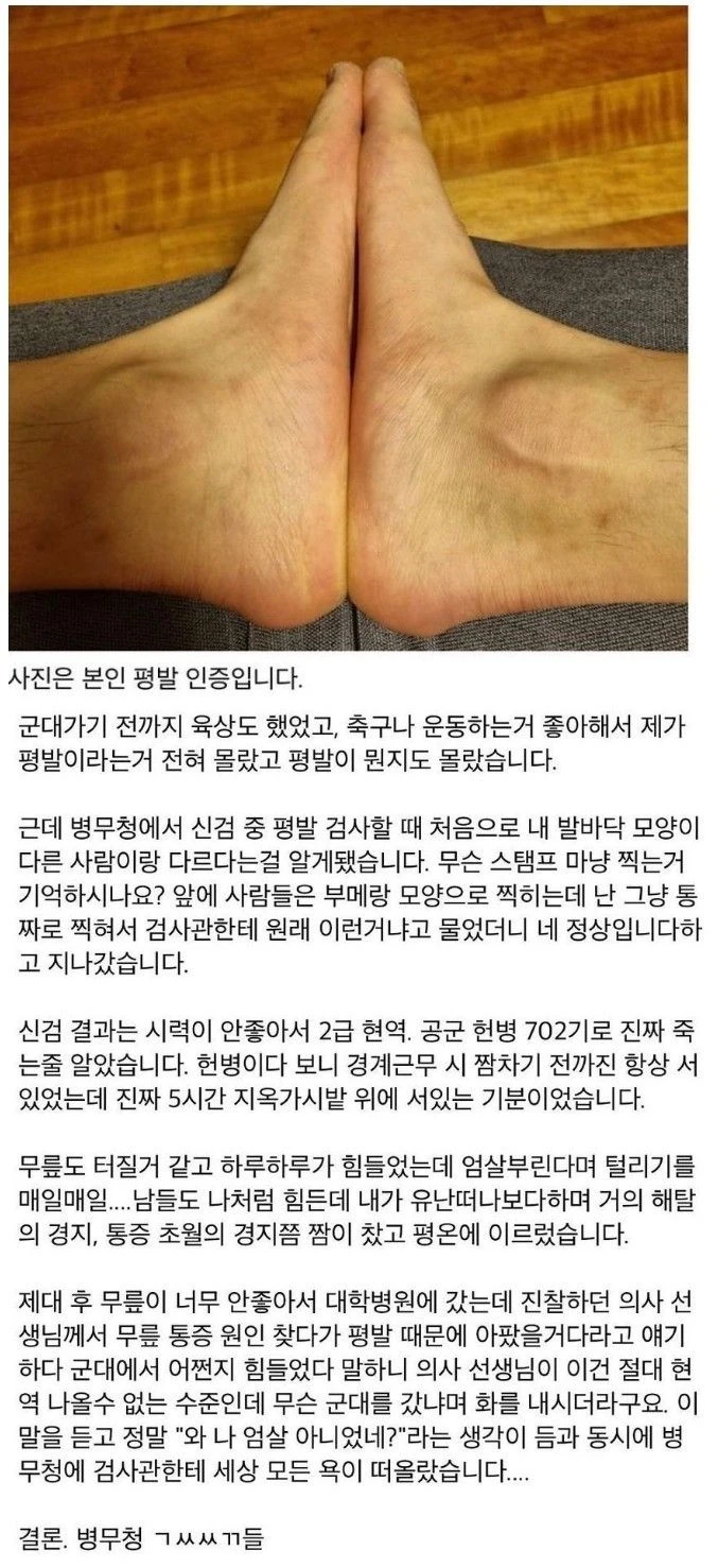 의사도 기겁한 현역(2급) 군인의 평발 상태